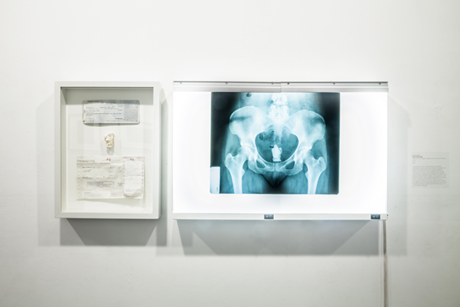 Noelle Mason's "Mule (HKG/ORD)" is an x-ray showing elephant ivory smuggled vaginally from Hong Kong to O’hare Airport (2007). - James Reiman
